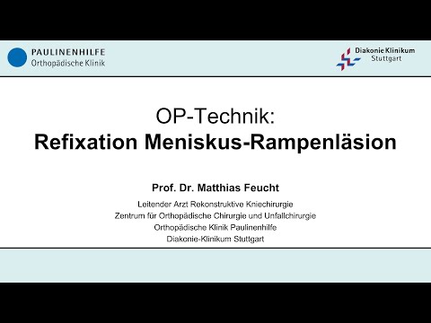 OP Technik - Refixation Meniskus Rampenläsion