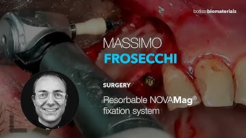 Resorbable NOVAMag® fixation system – Surgery by Dr. Massimo Frosecchi