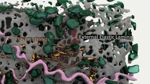 Perfusion Fixed Arterial Segment (Maya Arnold rendering)