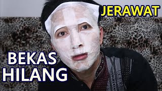 Masker Putih Telur UNTUK PEJUANG JERAWAT