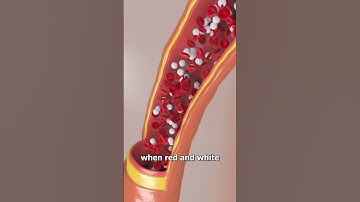 Why You See Floating Dots In The Sky 🤔