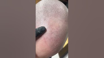 Where to get Best SMP?? #scalpmicropigmentation