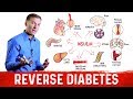 How to Reverse Damage from Diabetes?  – Dr.Berg on Reversing Diabetes