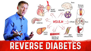 How to Reverse Damage from Diabetes?  – Dr.Berg on Reversing Diabetes