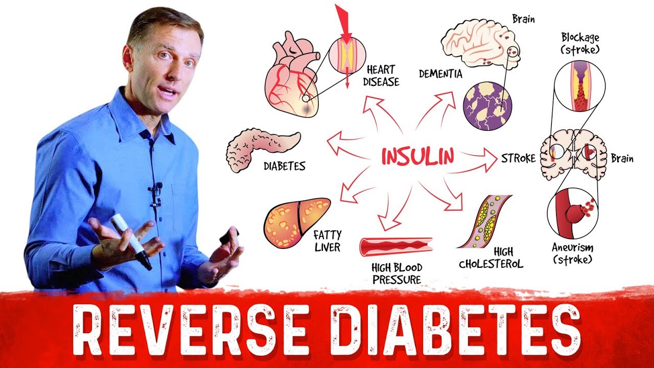 ⁣How to Reverse Damage from Diabetes?  – Dr.Berg on Reversing Diabetes