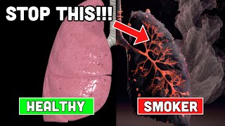 Doctor Explains: How to PURIFY Smokers Lungs!