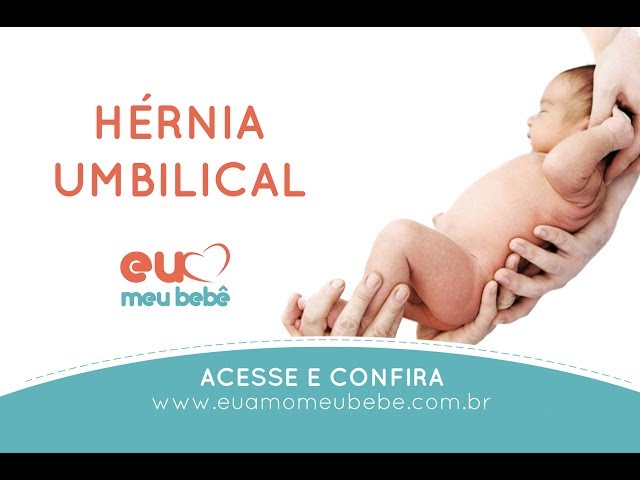 Hérnia umbilical em crianças - Problemas de saúde infantil