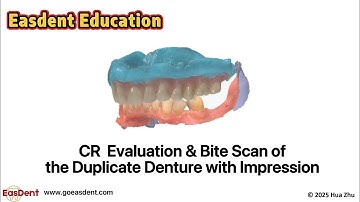 CR Evaluation and Bite Relationship Scan of the Duplicate Denture with Impression
