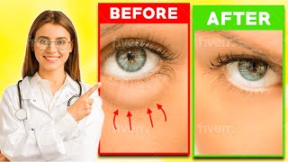 How To Fix Puffy Eyes