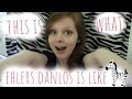 This Is What Ehlers Danlos Syndrome Is Like