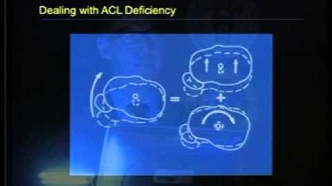 Knee Kinematics and graft Biomech Dr Andy W