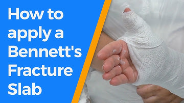 How to apply a Bennett