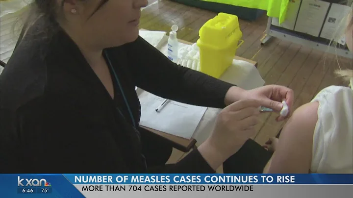 Officials urge immunization as 2019 measles cases soar to over 700 in US