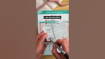 Fetal Heart Strips Explained 🍼🩺💖 #RN #BSN #futurenurse