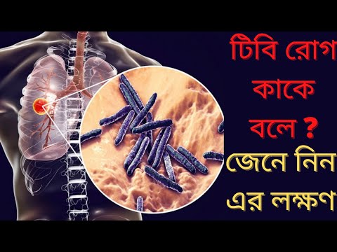 | What Is Tb Disease In Bangla