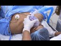 The Deep Sleep Before A Plastic Surgery - Anesthesia Procedure