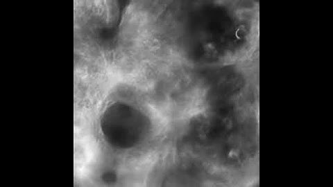 Protocell self-organization