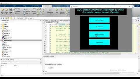 Arrhythmia Detection using ECG Matlab Projects | Arrhythmia Detection using ECG Matlab Thesis