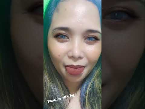 Lip Filler Gone