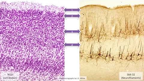 Overview of Cortex and Cortical Circuits part 1
