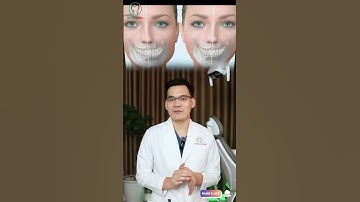 Niềng răng có cải thiện lệch mặt không? #chinhnha #niengrang #lechmat