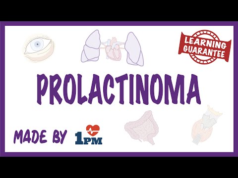 Video: Prolactinoom - Behandeling, Symptomen, Diagnose