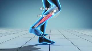 What Is Fes? How Functional Electrical Stimulation Works