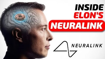 The Truth About Elon Musk’s Neuralink – How It’s Changing Humanity Forever