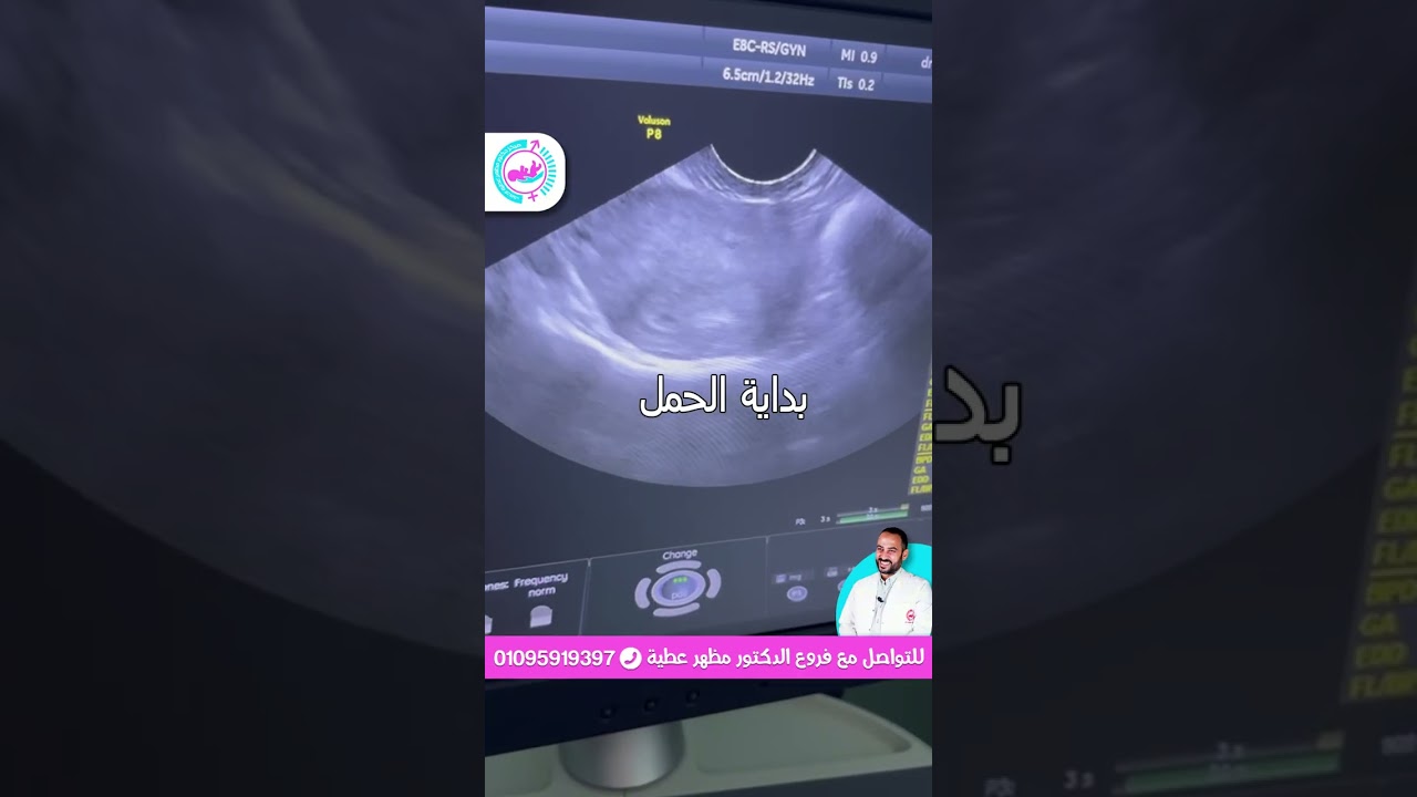 بداية الحمل