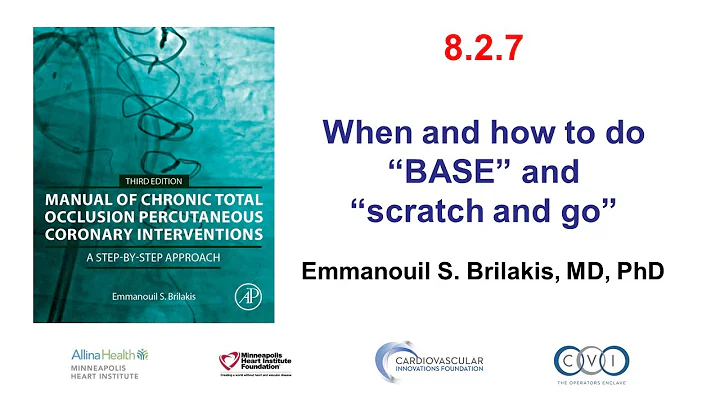 Video 8.2.7: Manual of CTO PCI - When and how to do “BASE” and “scratch and go”