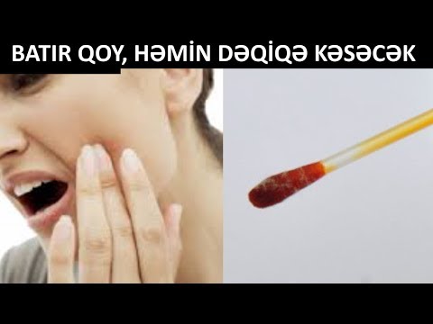 Video: Diş Kabinetinizi Necə Açmaq Olar?