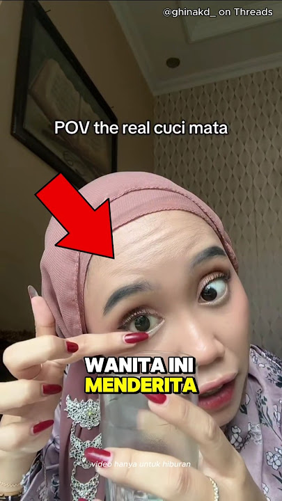 Wanita ini Menangis Karena Kehilangan Matanya 💔 #shorts