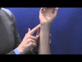 UE Hand: The Fovea Sign | IAOM-US