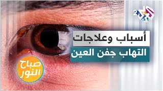 التهاب جفن العين .. الأسباب والعلاجات