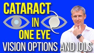 IOL for cataract in one eye only