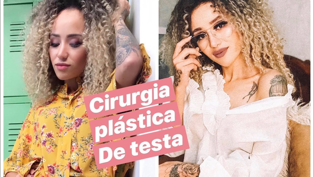 Qual O Valor De Uma Redução De Testa?