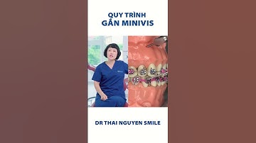 Quy trình cắm minivis niềng răng | Dr Thái Nguyễn Smile #nhakhoa #nhasi #niengrang #minivis #shorts