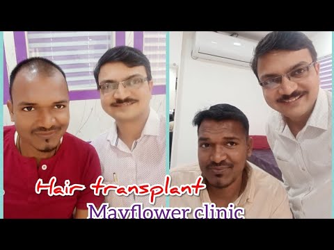 Best hair transplant in  New Roots Hair Transplant Center  Facebook