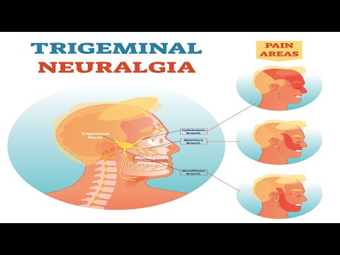 Video: Intercostal Neuralgia: Gejala, Penyebab, Obat, Pengobatan Lainnya