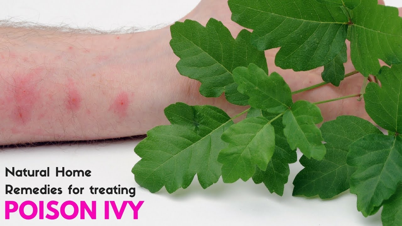 How to Treat Poison Ivy NATURALLY at Home - Natural Home Remedies for ...