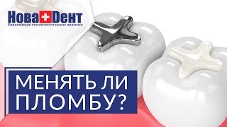 🔦  Чем световая пломба отличается от обычной, в чем ее плюсы. Световая пломба. НоваДент. 12+