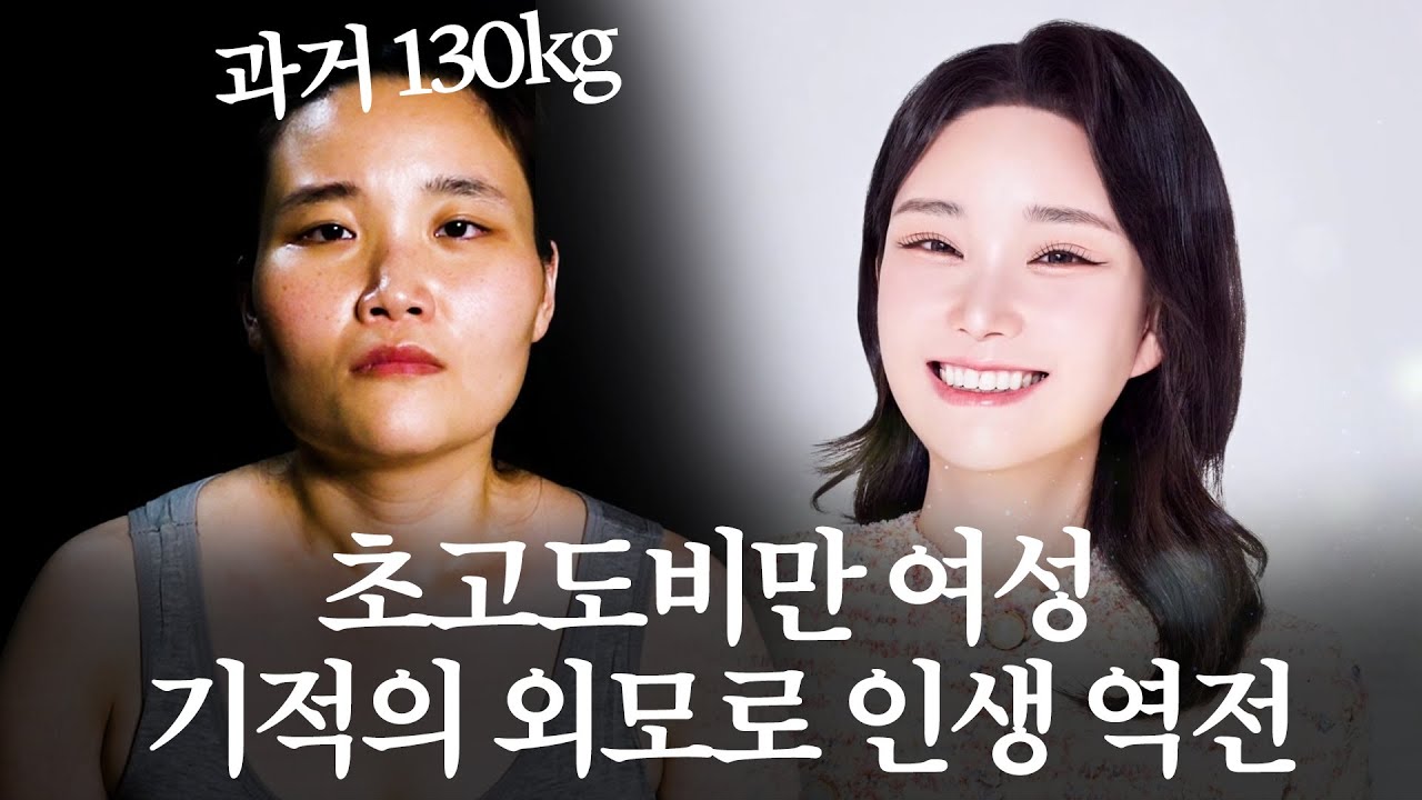 초고도비만 여성, 기적의 외모로 인생 역전｜MAKE ME Girl