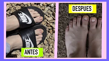 ¿Cómo blanquear las uñas de los pies?