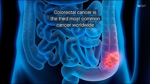 The PI3K/AKT signaling pathway: A mediator of metastasis in colorectal cancer