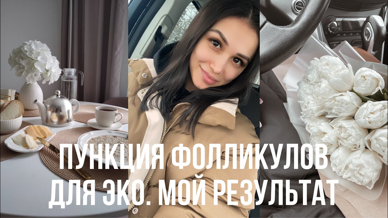 Как прошла пункция фолликулов при ЭКО. Результат оплодотворения.
