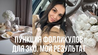 Как прошла пункция фолликулов при ЭКО. Результат оплодотворения.