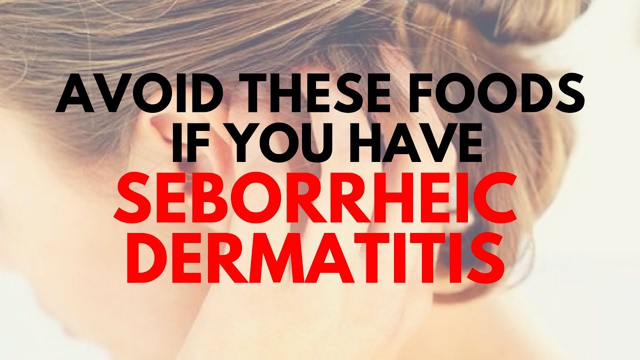 Foods To Avoid With Seborrheic Dermatitis Youtube