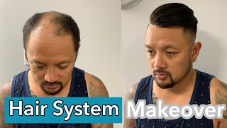 Huge Transformation| Mens Hair Replacement System