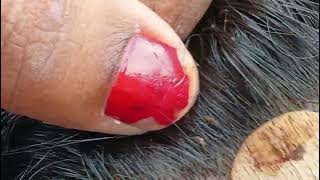 Download lagu lots of nits#viral#share#pls subscribe#