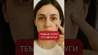 Темные круги под глазами ЧТО ДЕЛАТЬ?! #синякиподглазами #отеки #сон #косметология #аюна #косметика